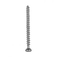 Orthopedic Implants